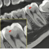 Rayos X Dental 3D Cone Beam Panorámico y Lateral Digital Vatech Green X 12 RC