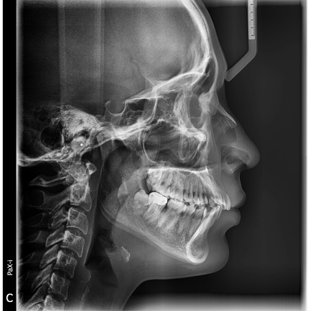 xRayos X Dental Panorámico y Lateral Digital Pax i Plus RC Vatech