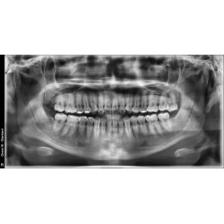 Rayos X Digital 3D Vatech Green 16 RC ( FOV 16x9) Panorámico y Lateral de Cráneo