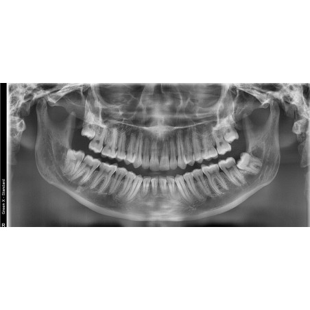 Rayos X Dental 3D Cone Beam Panorámico y Lateral Digital Vatech Green X 18 RC