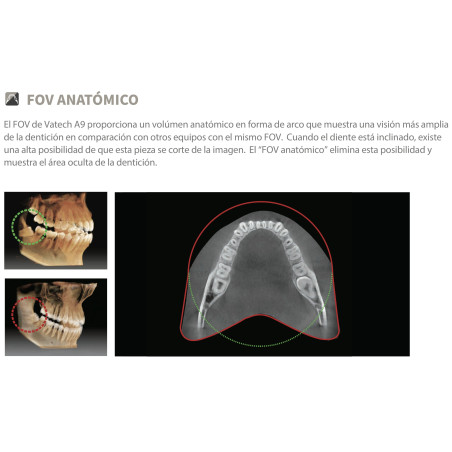 USADO Rayos X Dental 3D Cone Beam Panorámico y Lateral Digital Vatech  A9 RC
