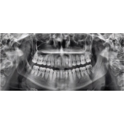 Rayos X Dental Panorámico Digital Pax i SP Vatech