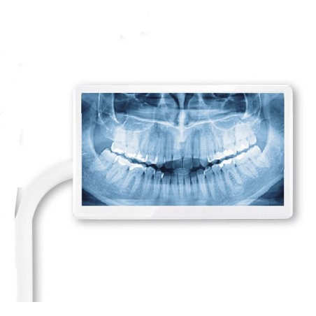 Soporte Universal Sencillo para Pantalla Unidad Dental