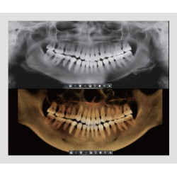 Rayos X Digital Vatech Pax-i SC - Panorámico y Lateral de Cráneo