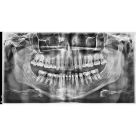 Rayos X Dental 3D Cone Beam Panorámico y Lateral Digital Vatech  A9 RC