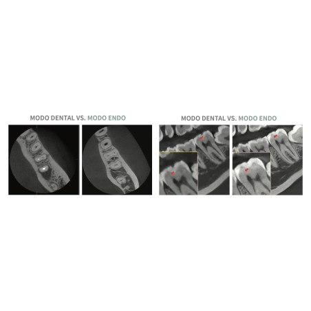 Rayos X Dental 3D Cone Beam Panorámico y Lateral Digital Vatech Green X 18 RC