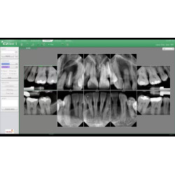 Rayos X Dental Pórtatil Vatech Ez Ray Air
