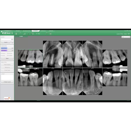 Paquete Radiovisiógrafo Ez Sensor Classic + Rayos X Dental Portátil Ez Ray Air Vatech