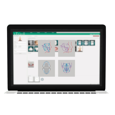 Software para Cefalometría Automática Ez Ortho Vatech