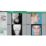 Software para Cefalometría Automática Ez Ortho Vatech