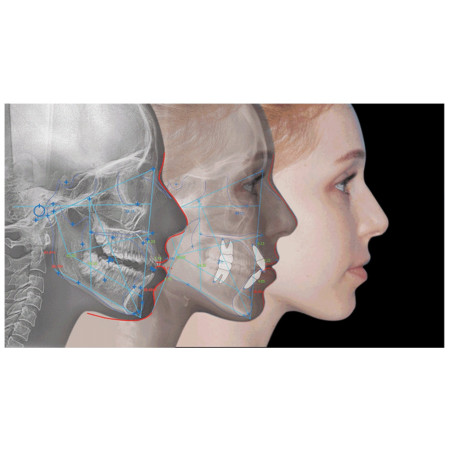 Software para Cefalometría Automática Ez Ortho Vatech